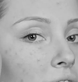 skin