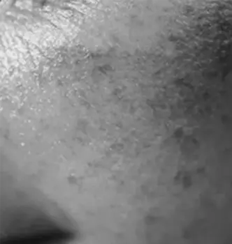 skin